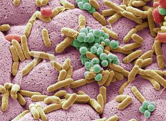 Samolepka flie 100 x 73  Bacteria found on dishcloth, SEM, 100 x 73 cm