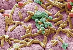 Fototapeta papr 184 x 128, 226312177 - Bacteria found on dishcloth, SEM
