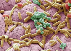 Fototapeta240 x 174  Bacteria found on dishcloth, SEM, 240 x 174 cm