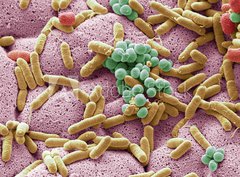 Fototapeta330 x 244  Bacteria found on dishcloth, SEM, 330 x 244 cm