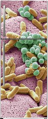 Samolepka na lednici flie 80 x 200, 226312177 - Bacteria found on dishcloth, SEM - Bakterie nalezen na utrce, SEM