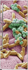 Samolepka na lednici flie 80 x 200, 226312177 - Bacteria found on dishcloth, SEM