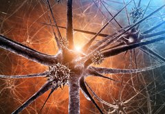 Fototapeta174 x 120  Viral encephalitis d illustration, 174 x 120 cm