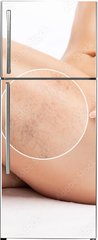 Samolepka na lednici flie 80 x 200, 524125512 - Beautiful slender woman sits on a couch in a spa salon. She shows varicose veins in the lower legs.Treatment of varicose veins and capillaries.