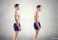 Samolepka flie 145 x 100, 66813369 - Man with impaired posture position defect scoliosis and ideal - Mu s poruchou postojov polohy defoli skoliza a ideln