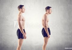 Fototapeta174 x 120  Man with impaired posture position defect scoliosis and ideal, 174 x 120 cm