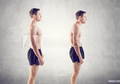 Fototapeta184 x 128  Man with impaired posture position defect scoliosis and ideal, 184 x 128 cm