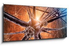 Sklenn obraz 1D panorama - 120 x 50 cm F_AB33468272 - Viral encephalitis , 3d illustration