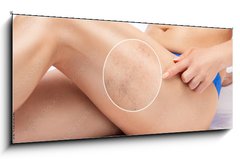 Skleněný obraz 1D panorama - 120 x 50 cm F_AB524125512 - Beautiful slender woman sits on a couch in a spa salon. She shows varicose veins in the lower legs.Treatment of varicose veins and capillaries.