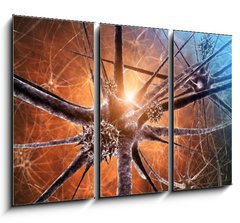 Obraz 3D tdln - 105 x 70 cm F_BB33468272 - Viral encephalitis , 3d illustration - Virov encefalitidy, 3d ilustrace