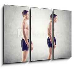 Obraz   Man with impaired posture position defect scoliosis and ideal, 105 x 70 cm