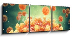 Obraz 3D tdln - 150 x 50 cm F_BM299804686 - Chronic liver disease can be caused by a viral hepatitis infection, Hepatitis viruses