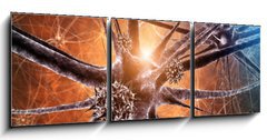 Obraz 3D třídílný - 150 x 50 cm F_BM33468272 - Viral encephalitis , 3d illustration - Virové encefalitidy, 3d ilustrace