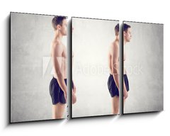 Obraz 3D tdln - 90 x 50 cm F_BS66813369 - Man with impaired posture position defect scoliosis and ideal - Mu s poruchou postojov polohy defoli skoliza a ideln