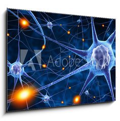 Obraz 1D - 100 x 70 cm F_E78707112 - nerve cells - nervov buky