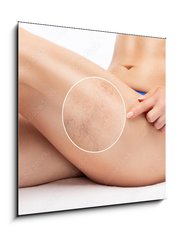 Obraz 1D - 50 x 50 cm F_F524125512 - Beautiful slender woman sits on a couch in a spa salon. She shows varicose veins in the lower legs.Treatment of varicose veins and capillaries.