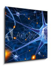 Sklenn obraz 1D - 50 x 50 cm F_F78707112 - nerve cells - nervov buky