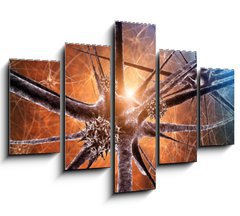Obraz   Viral encephalitis d illustration, 150 x 100 cm