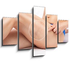 Obraz 5D ptidln - 150 x 100 cm F_GB524125512 - Beautiful slender woman sits on a couch in a spa salon. She shows varicose veins in the lower legs.Treatment of varicose veins and capillaries.