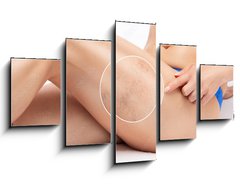Obraz 5D ptidln - 125 x 70 cm F_GS524125512 - Beautiful slender woman sits on a couch in a spa salon. She shows varicose veins in the lower legs.Treatment of varicose veins and capillaries.