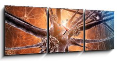 Obraz s hodinami   Viral encephalitis d illustration, 150 x 50 cm